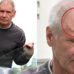 Harrison Ford get his scar